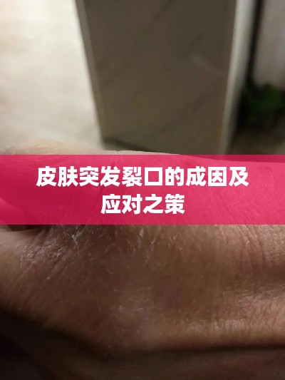 皮肤突发裂口的成因及应对之策