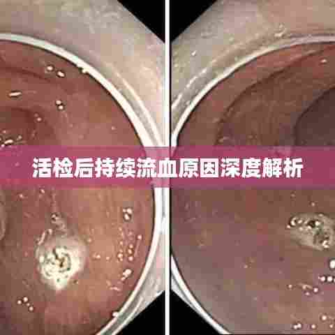 活检后持续流血原因深度解析