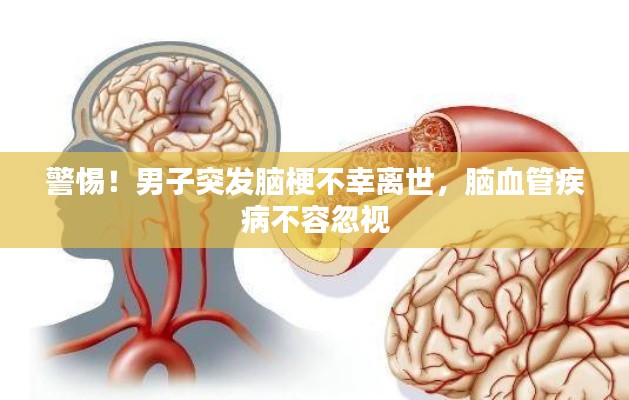 警惕！男子突发脑梗不幸离世，脑血管疾病不容忽视