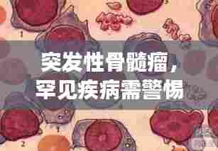 突发性骨髓瘤，罕见疾病需警惕！